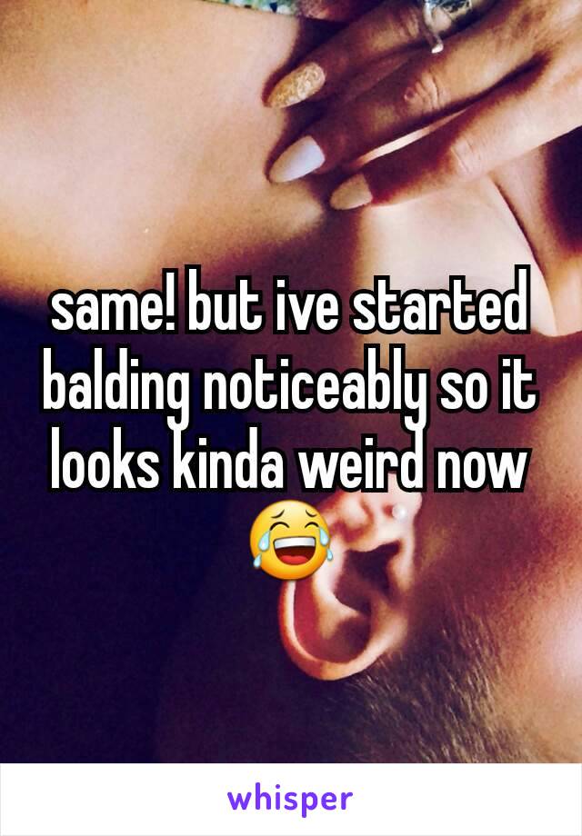 same! but ive started balding noticeably so it looks kinda weird now😂