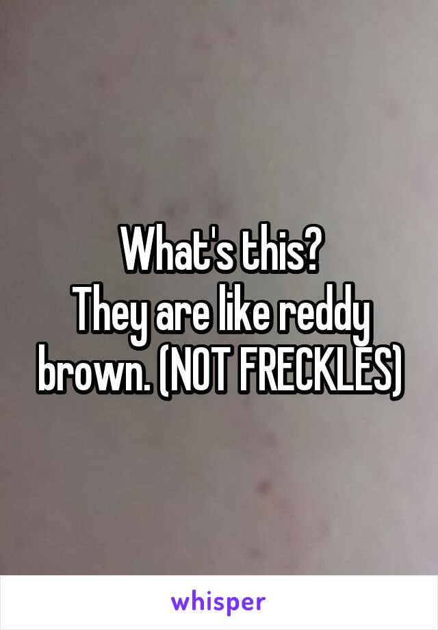 What's this?
They are like reddy brown. (NOT FRECKLES)