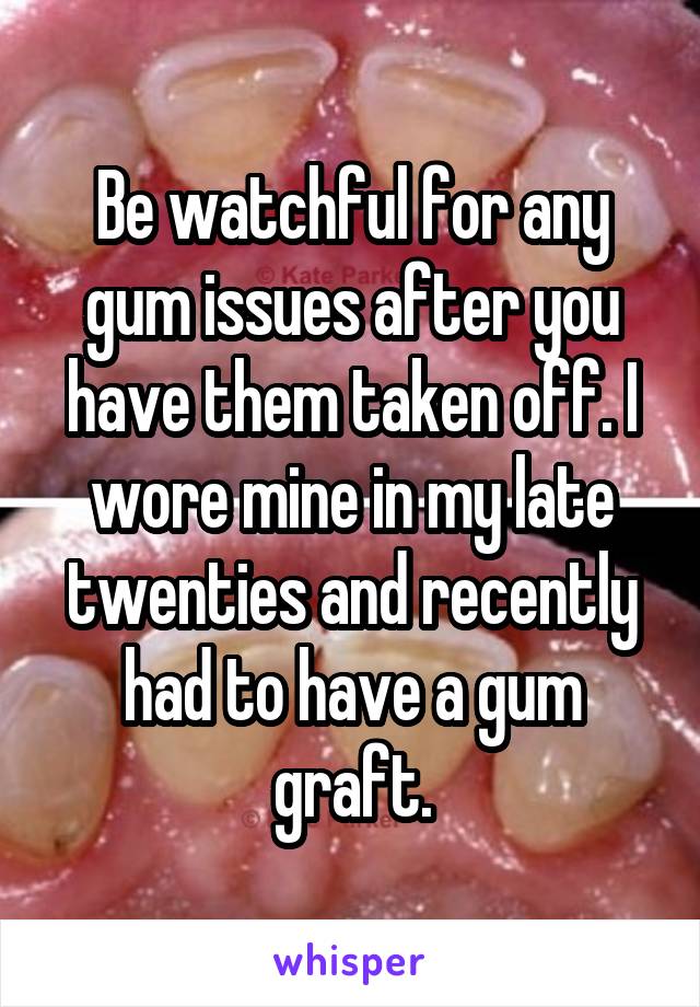 Be watchful for any gum issues after you have them taken off. I wore mine in my late twenties and recently had to have a gum graft.