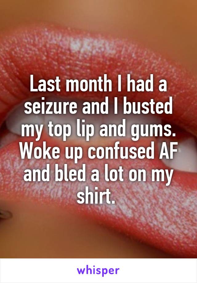 Last month I had a seizure and I busted my top lip and gums. Woke up confused AF and bled a lot on my shirt. 