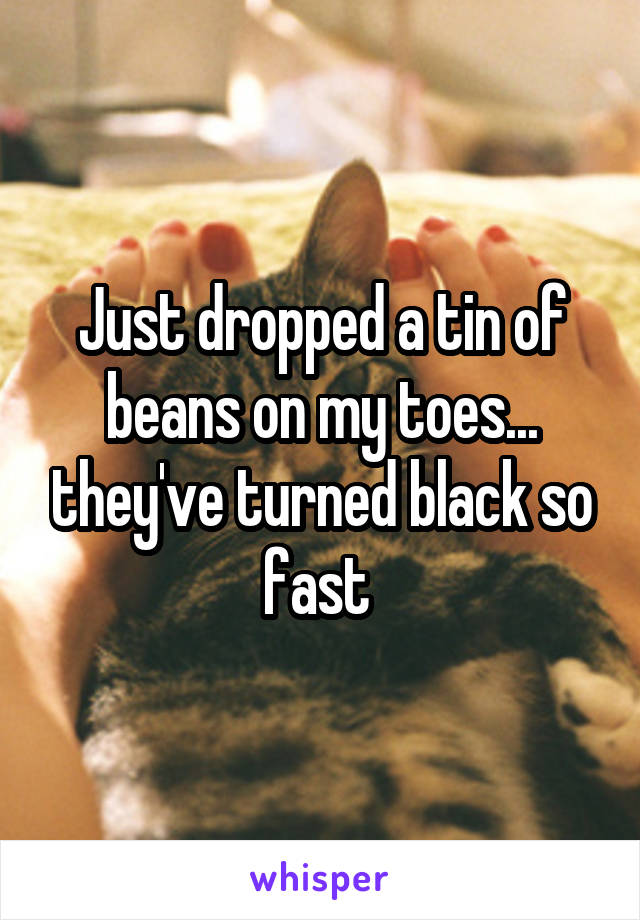 Just dropped a tin of beans on my toes... they've turned black so fast 