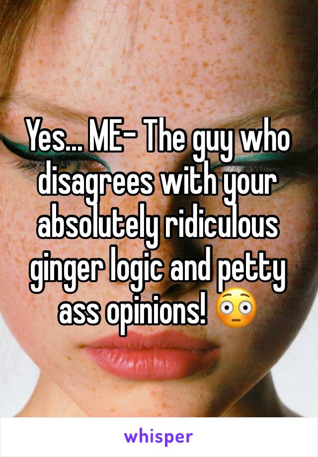 Yes... ME- The guy who disagrees with your absolutely ridiculous ginger logic and petty ass opinions! 😳