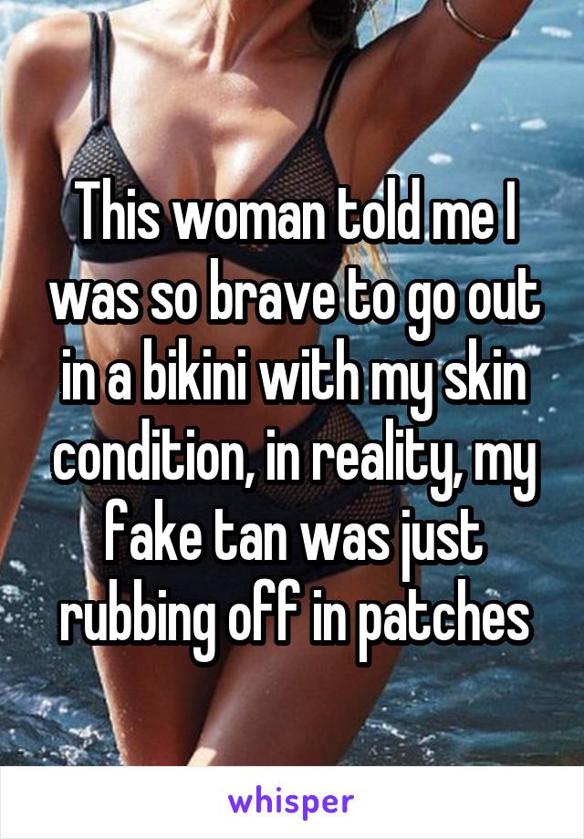 This woman told me I was so brave to go out in a bikini with my skin condition, in reality, my fake tan was just rubbing off in patches
