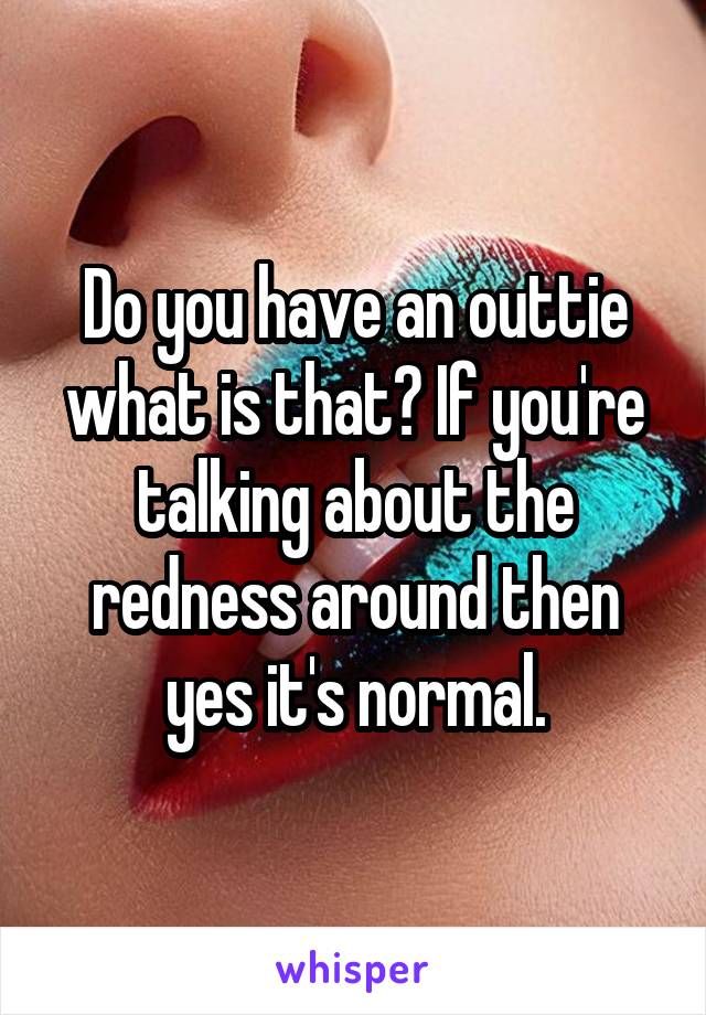 Do you have an outtie what is that? If you're talking about the redness around then yes it's normal.