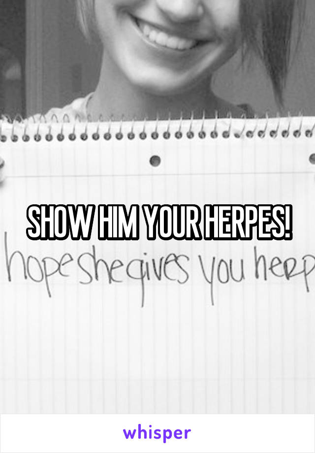 SHOW HIM YOUR HERPES!