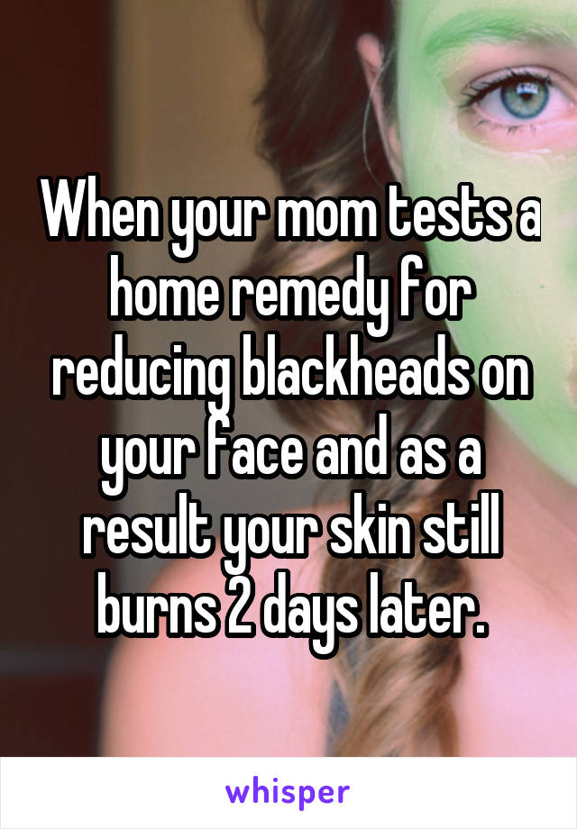 When your mom tests a home remedy for reducing blackheads on your face and as a result your skin still burns 2 days later.