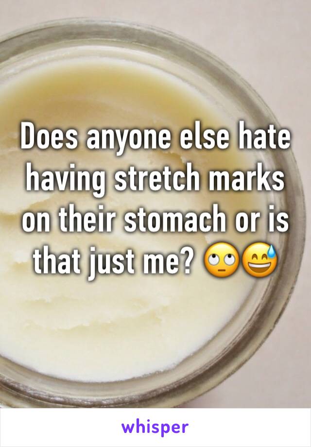 Does anyone else hate having stretch marks on their stomach or is that just me? 🙄😅