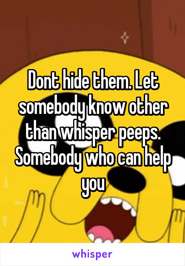 Dont hide them. Let somebody know other than whisper peeps. Somebody who can help you