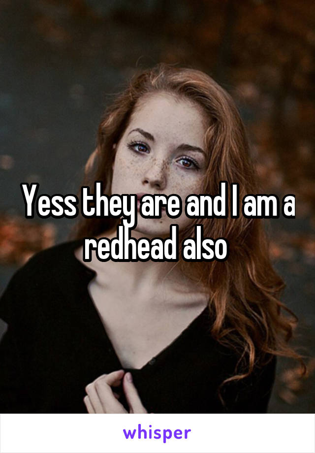 Yess they are and I am a redhead also 