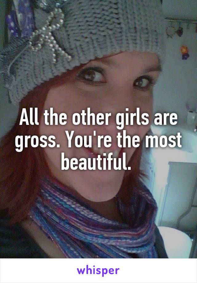 All the other girls are gross. You're the most beautiful. 