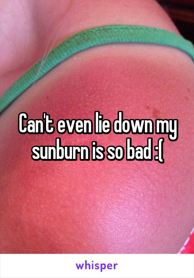 Can't even lie down my sunburn is so bad :(