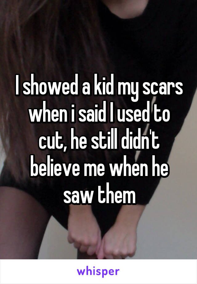 I showed a kid my scars when i said I used to cut, he still didn't believe me when he saw them