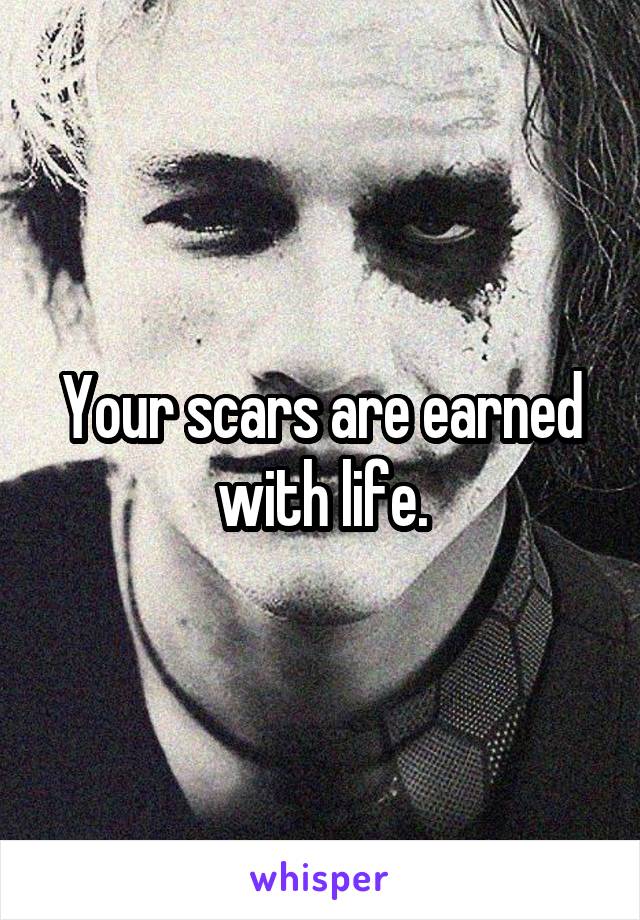 Your scars are earned with life.