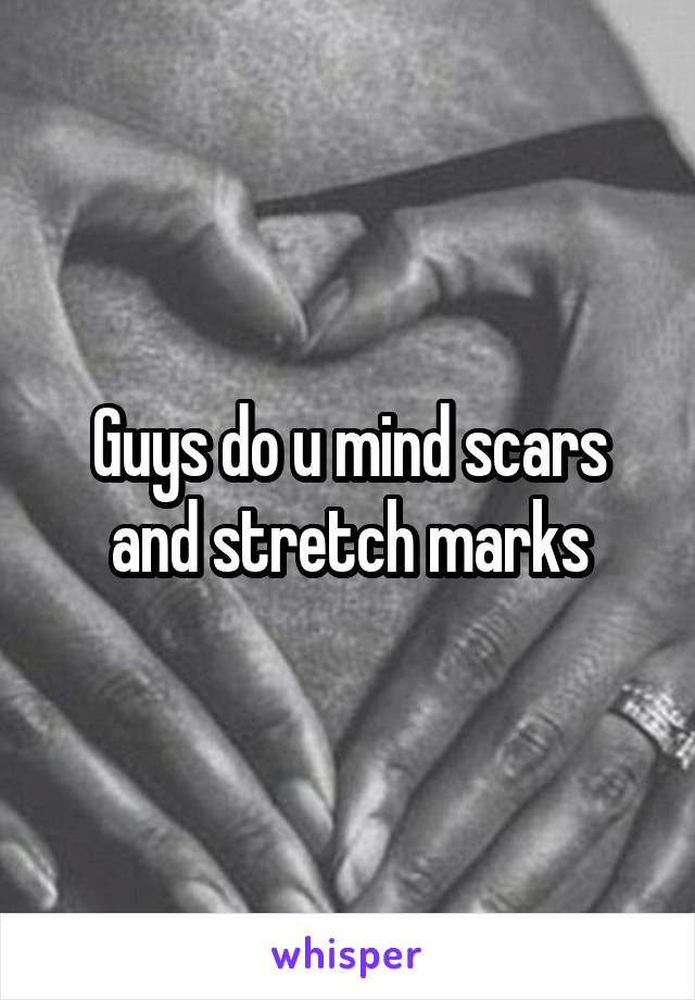 Guys do u mind scars and stretch marks