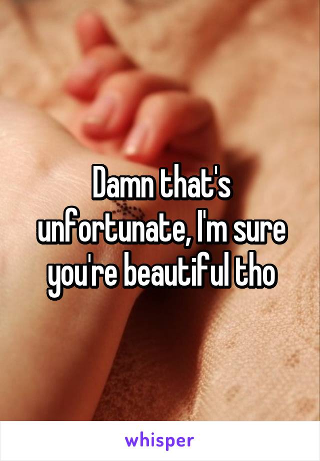 Damn that's unfortunate, I'm sure you're beautiful tho
