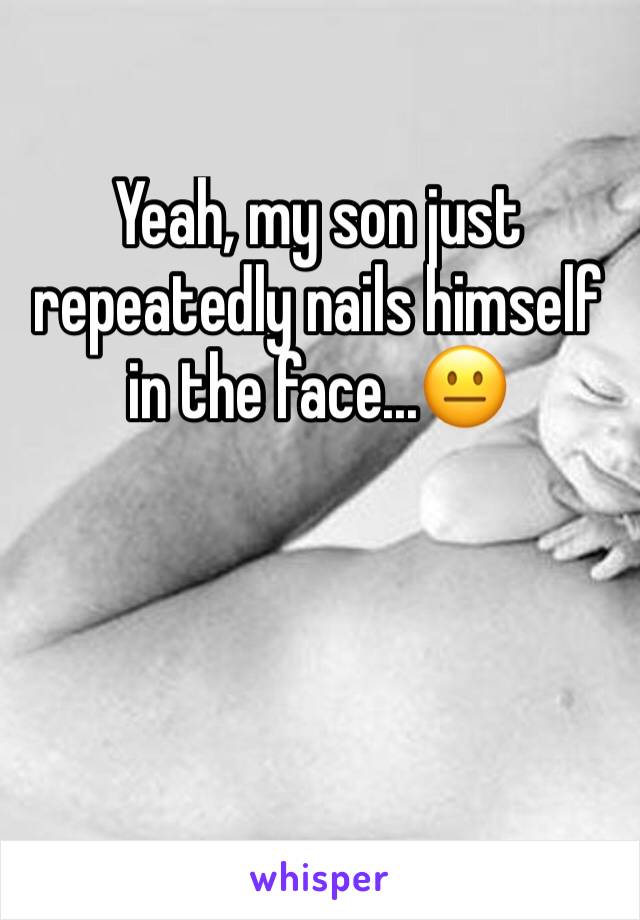 Yeah, my son just repeatedly nails himself in the face...😐