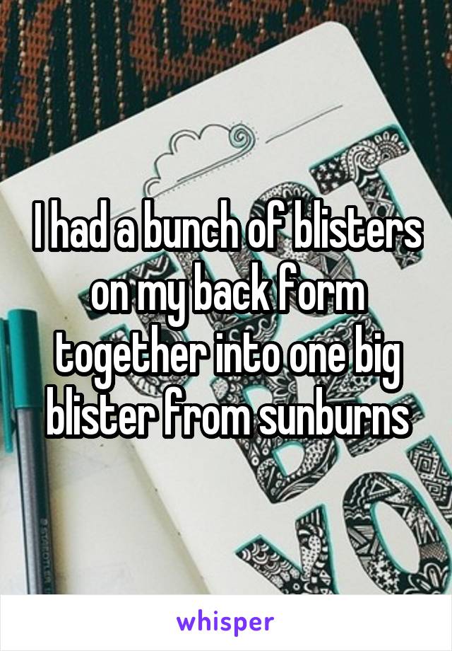 I had a bunch of blisters on my back form together into one big blister from sunburns