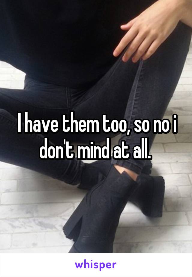 I have them too, so no i don't mind at all. 