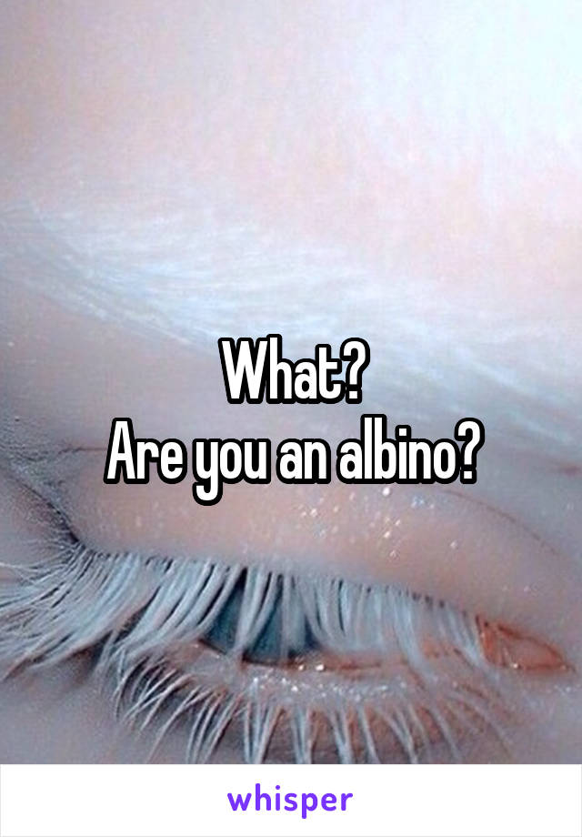 What?
Are you an albino?