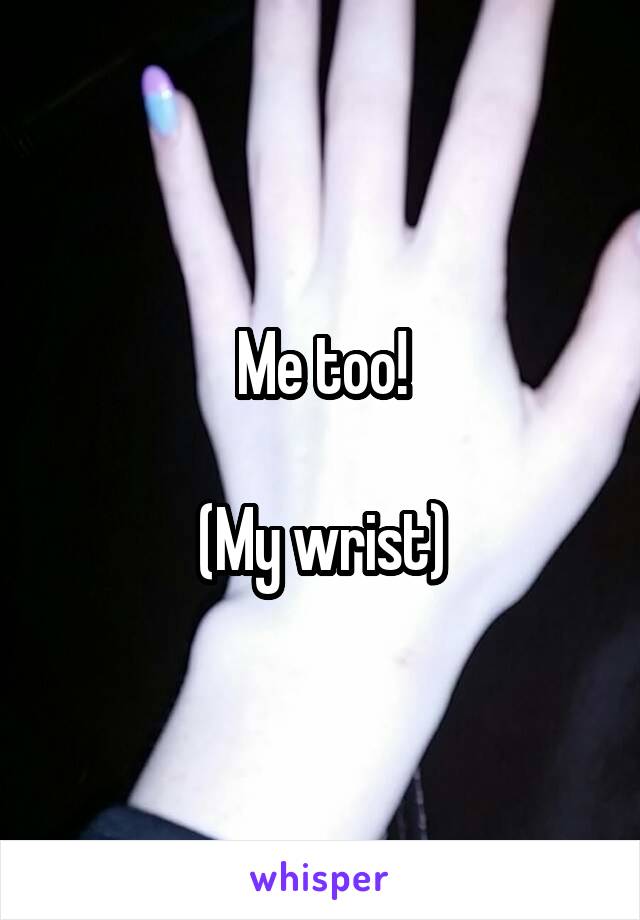 Me too!

(My wrist)