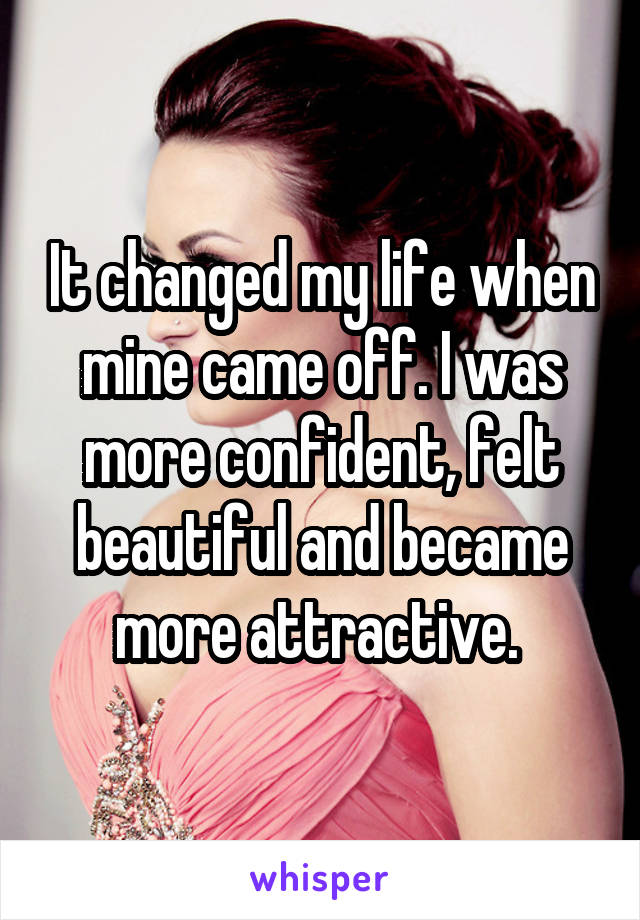 It changed my life when mine came off. I was more confident, felt beautiful and became more attractive. 