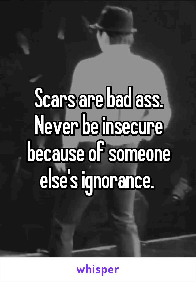 Scars are bad ass. Never be insecure because of someone else's ignorance. 