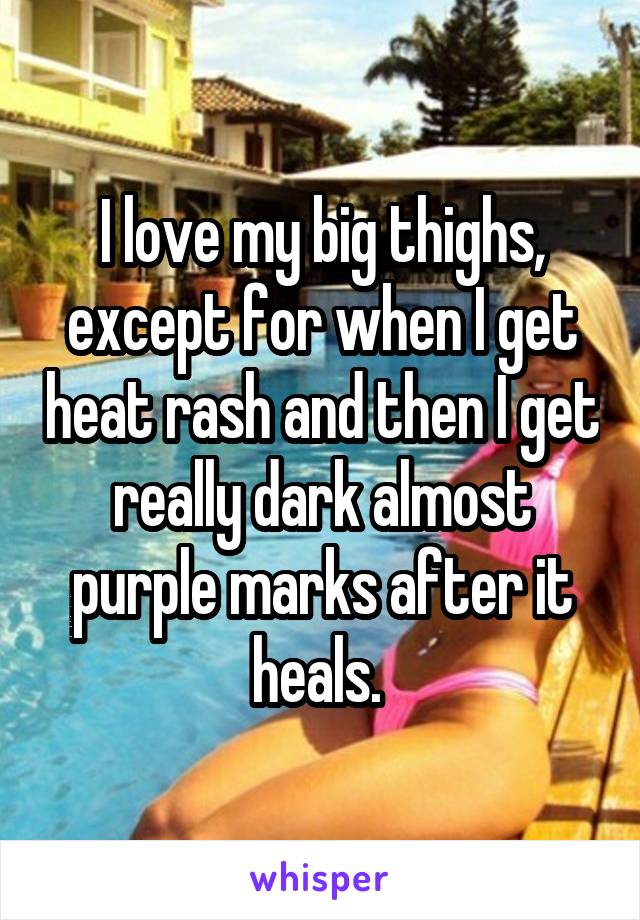 I love my big thighs, except for when I get heat rash and then I get really dark almost purple marks after it heals. 