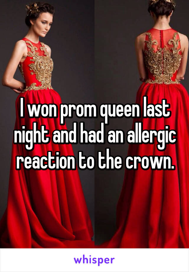 I won prom queen last night and had an allergic reaction to the crown.