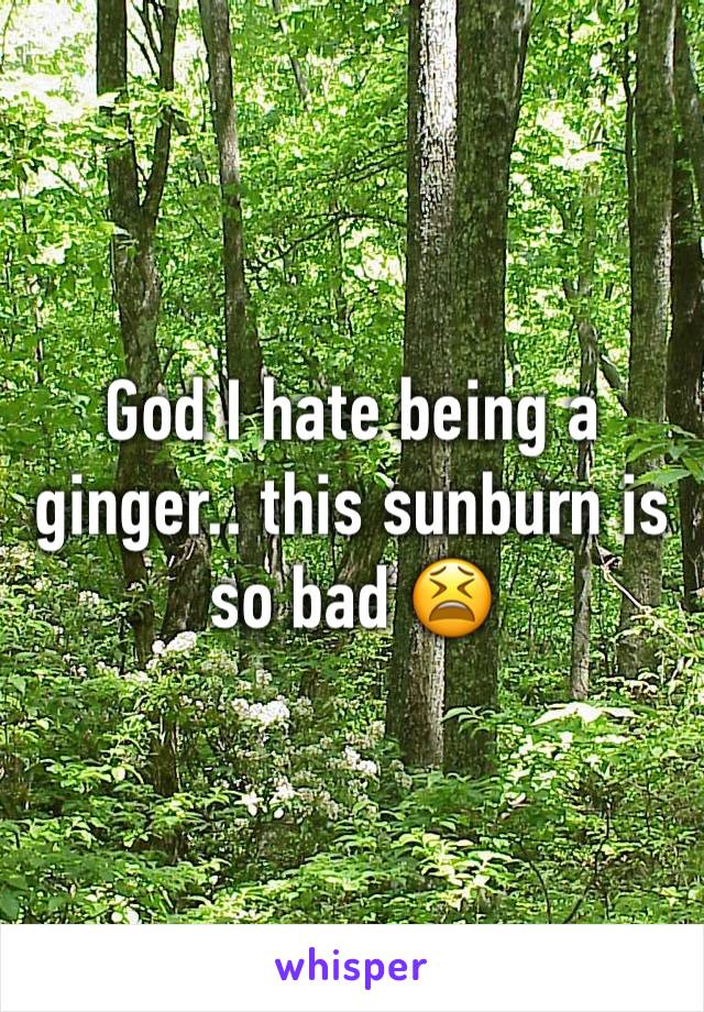 God I hate being a ginger.. this sunburn is so bad 😫