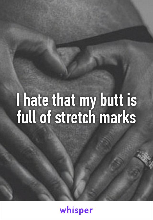 I hate that my butt is full of stretch marks