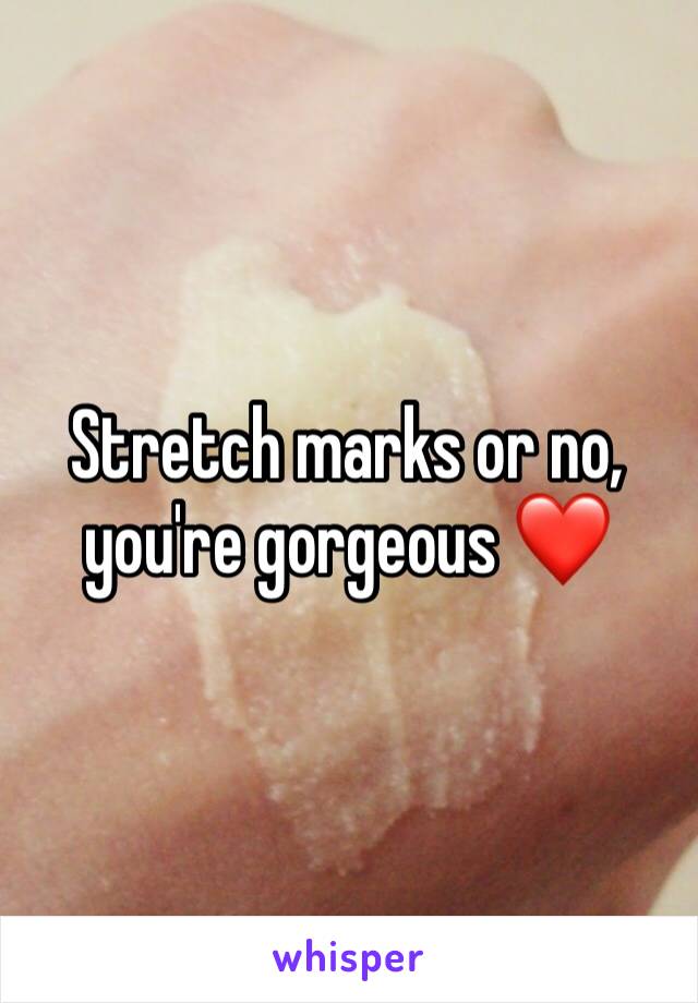 Stretch marks or no, you're gorgeous ❤️