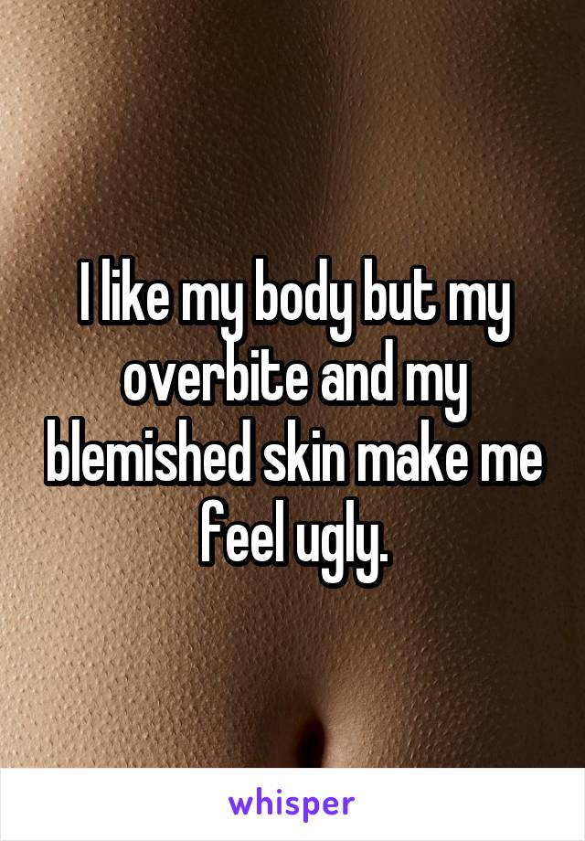 I like my body but my overbite and my blemished skin make me feel ugly.