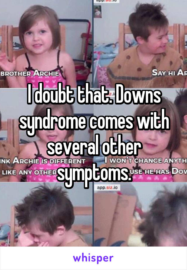 I doubt that. Downs syndrome comes with several other symptoms.