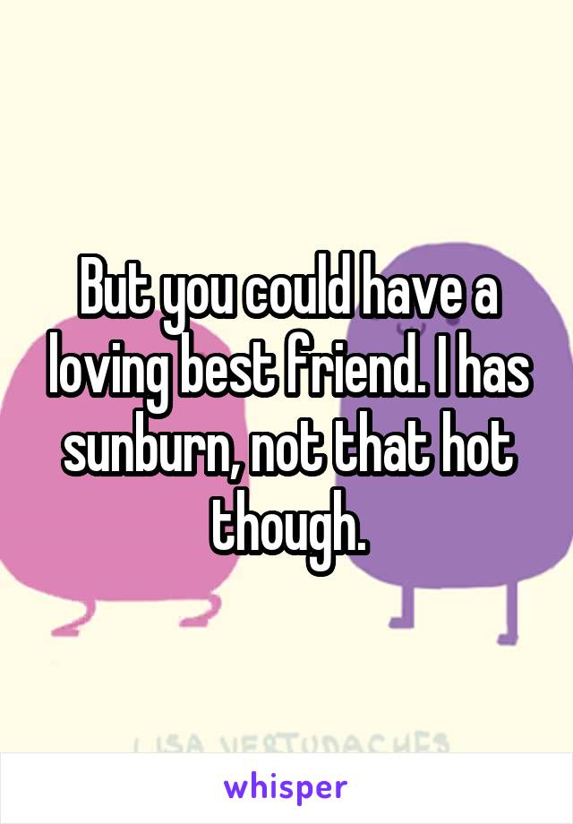 But you could have a loving best friend. I has sunburn, not that hot though.