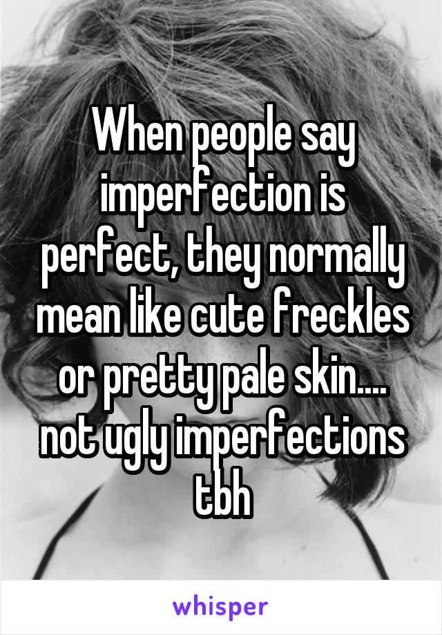 When people say imperfection is perfect, they normally mean like cute freckles or pretty pale skin.... not ugly imperfections tbh
