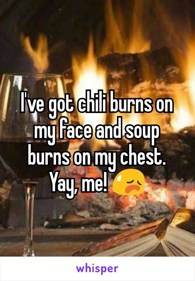 I've got chili burns on my face and soup burns on my chest. Yay, me! 😥