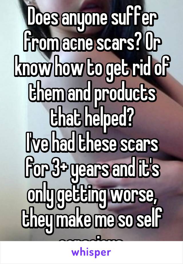 Does anyone suffer from acne scars? Or know how to get rid of them and products that helped?
I've had these scars for 3+ years and it's only getting worse, they make me so self conscious 