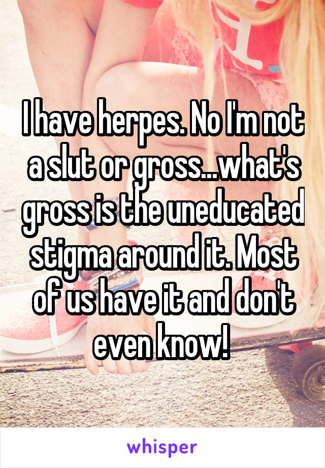 I have herpes. No I'm not a slut or gross...what's gross is the uneducated stigma around it. Most of us have it and don't even know! 