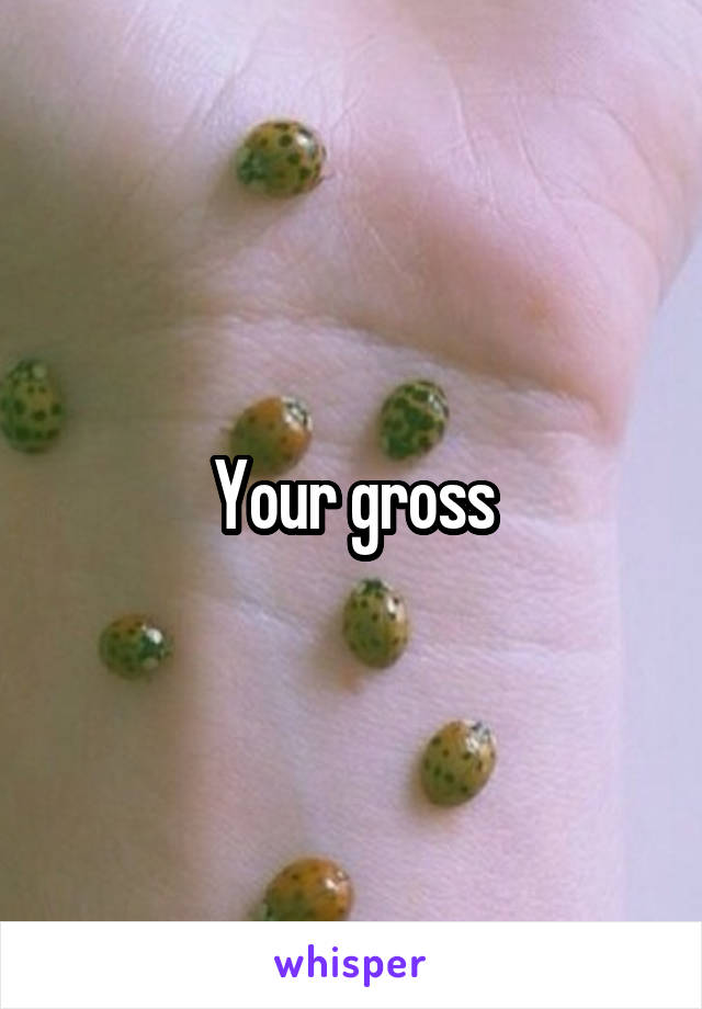 Your gross