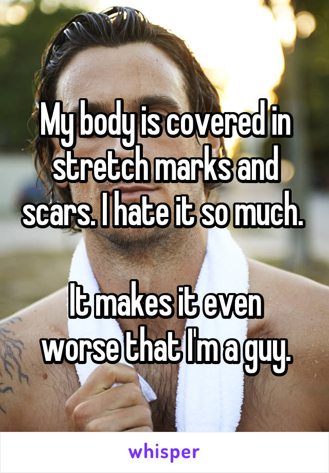 My body is covered in stretch marks and scars. I hate it so much. 

It makes it even worse that I'm a guy.
