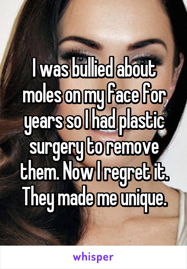 I was bullied about moles on my face for years so I had plastic surgery to remove them. Now I regret it. They made me unique.