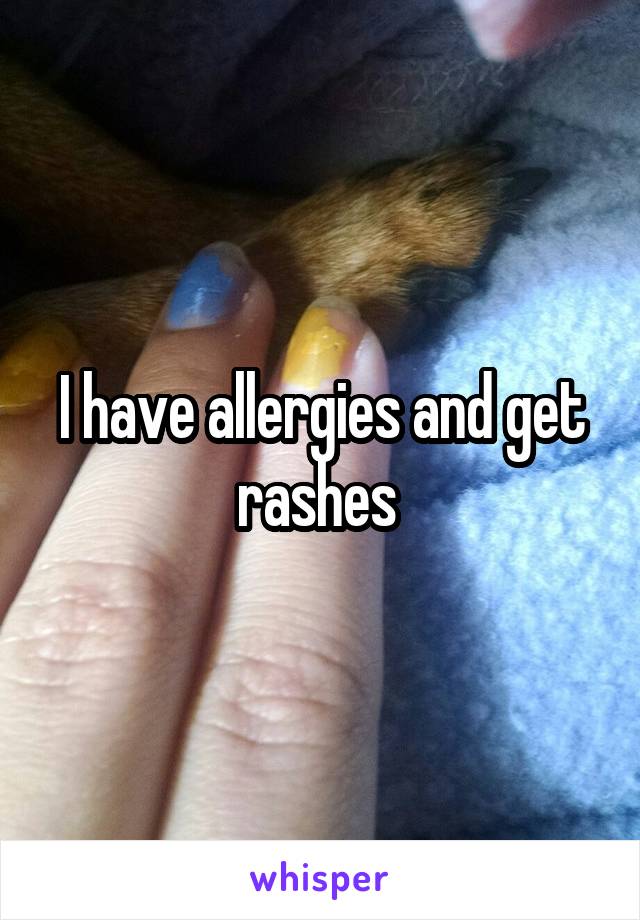 I have allergies and get rashes 