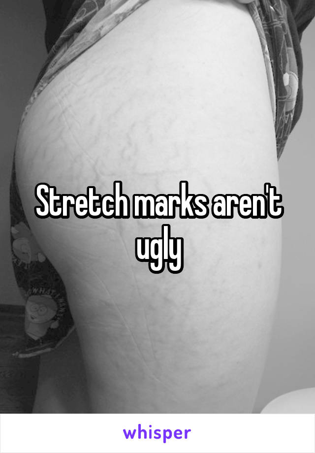 Stretch marks aren't ugly