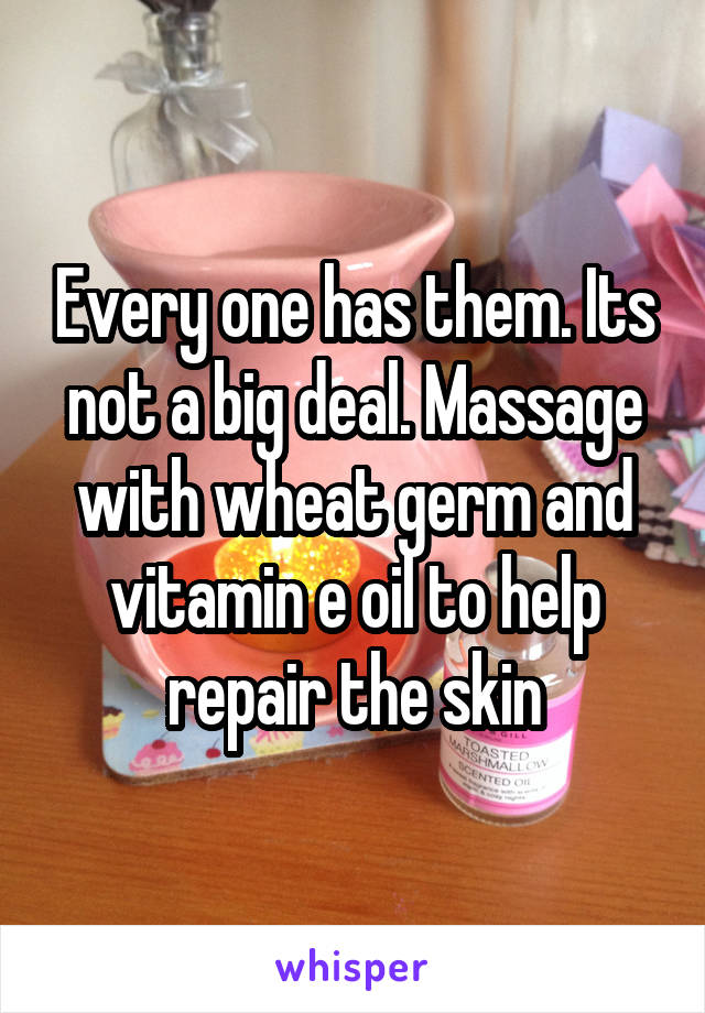 Every one has them. Its not a big deal. Massage with wheat germ and vitamin e oil to help repair the skin