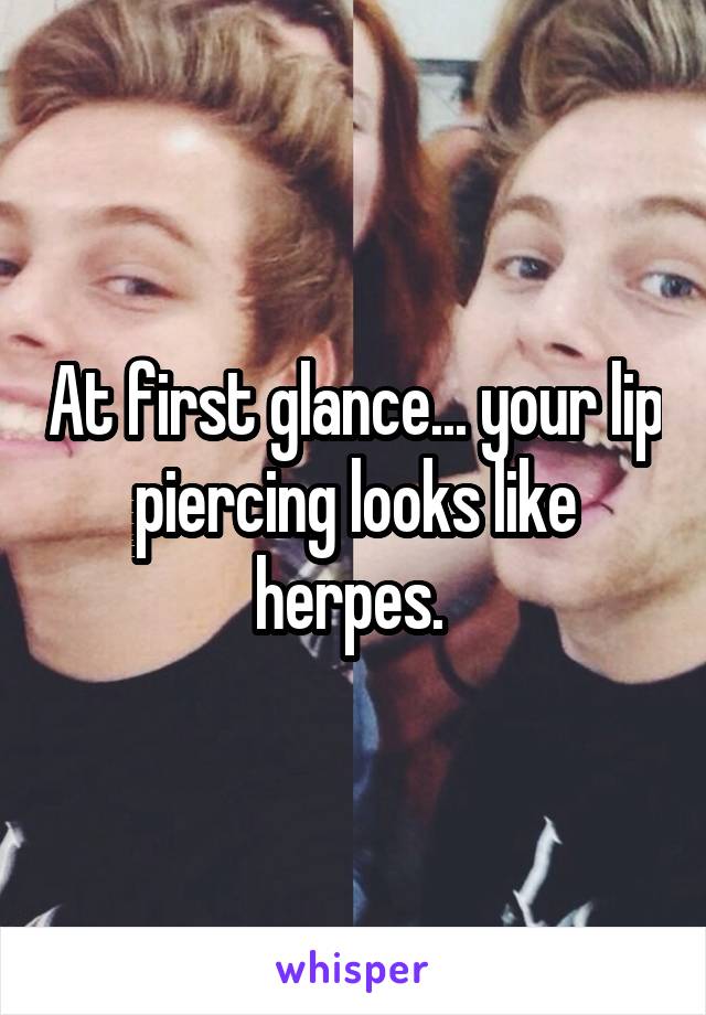 At first glance... your lip piercing looks like herpes. 