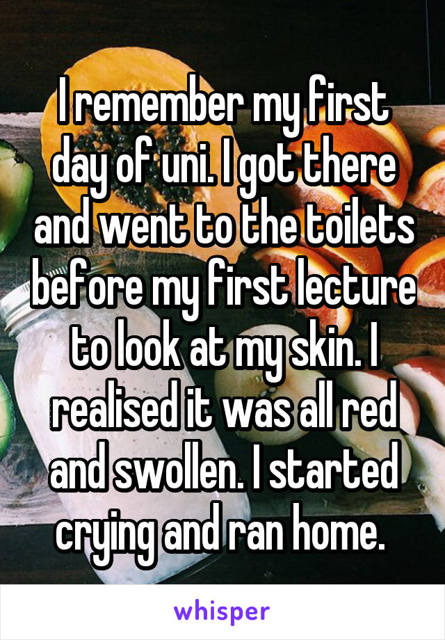 I remember my first day of uni. I got there and went to the toilets before my first lecture to look at my skin. I realised it was all red and swollen. I started crying and ran home. 