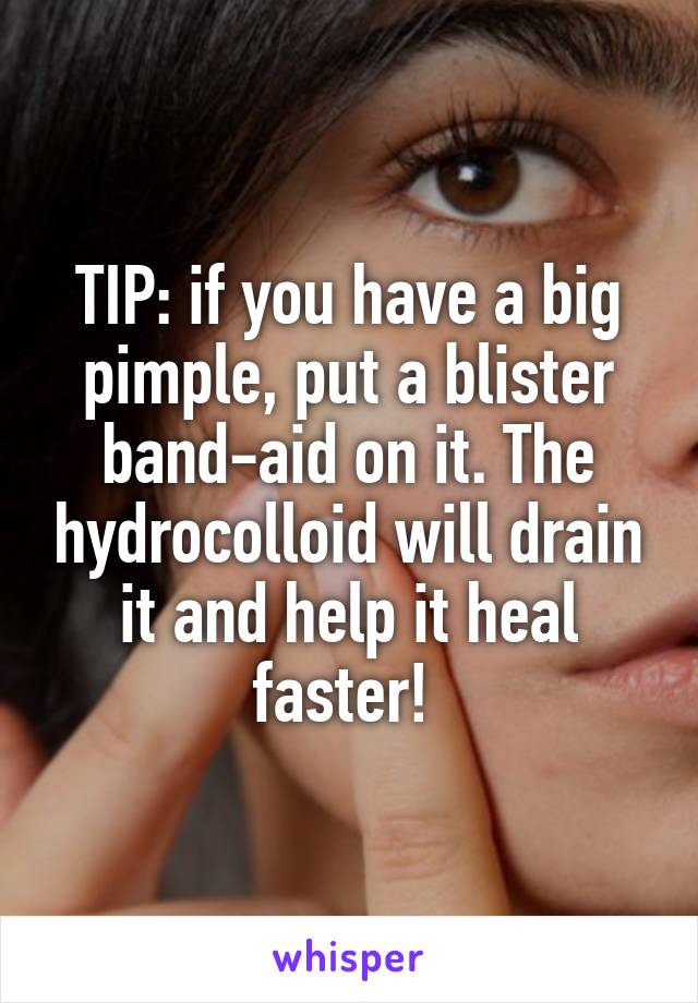 TIP: if you have a big pimple, put a blister band-aid on it. The hydrocolloid will drain it and help it heal faster! 