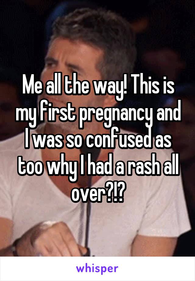 Me all the way! This is my first pregnancy and I was so confused as too why I had a rash all over?!?