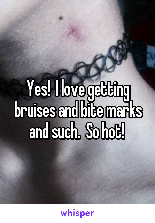 Yes!  I love getting bruises and bite marks and such.  So hot! 