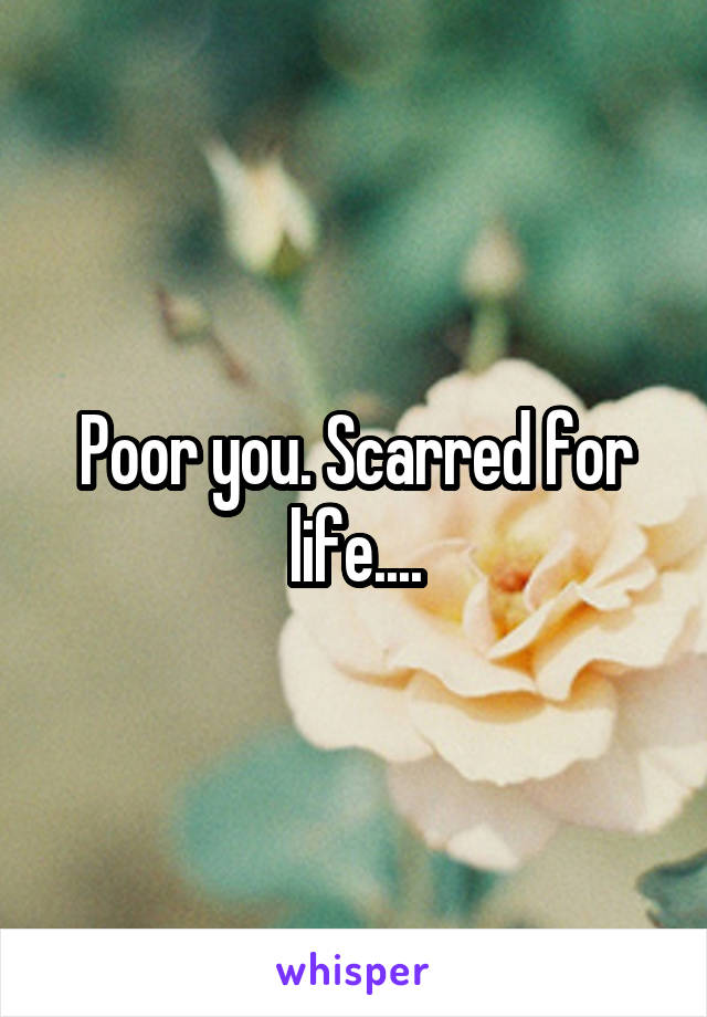 Poor you. Scarred for life....